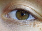 ojo izquierdo de Nerea